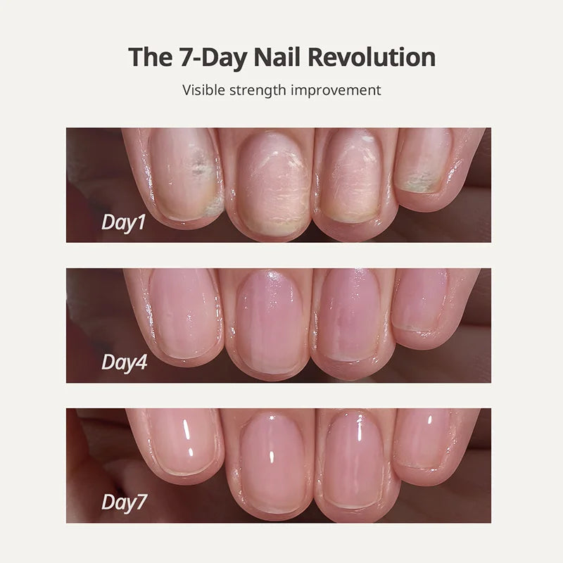 🔥Flash Sale 58% OFF🔥Nail Protection Oil : Strengthen and Grow Your Nails Safely