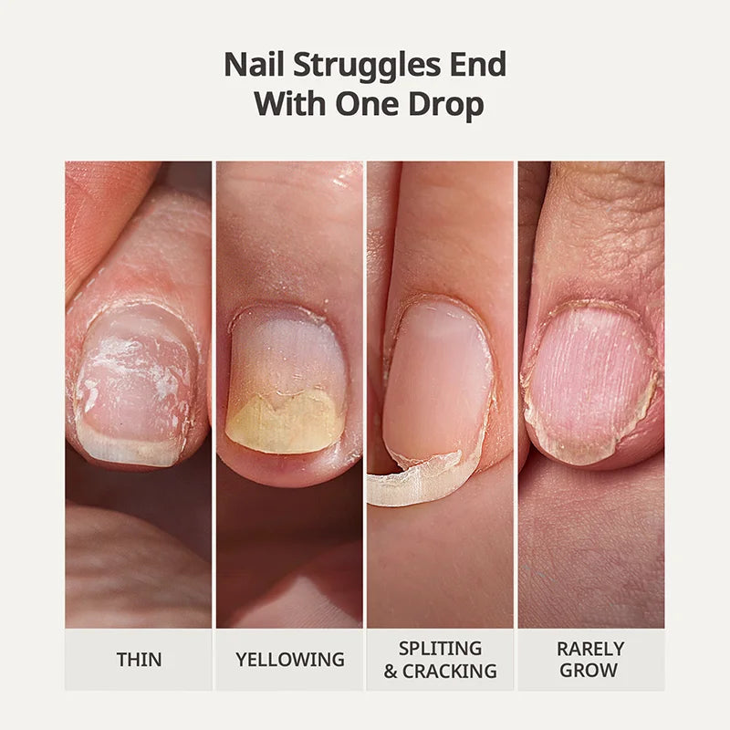 🔥Flash Sale 58% OFF🔥Nail Protection Oil : Strengthen and Grow Your Nails Safely