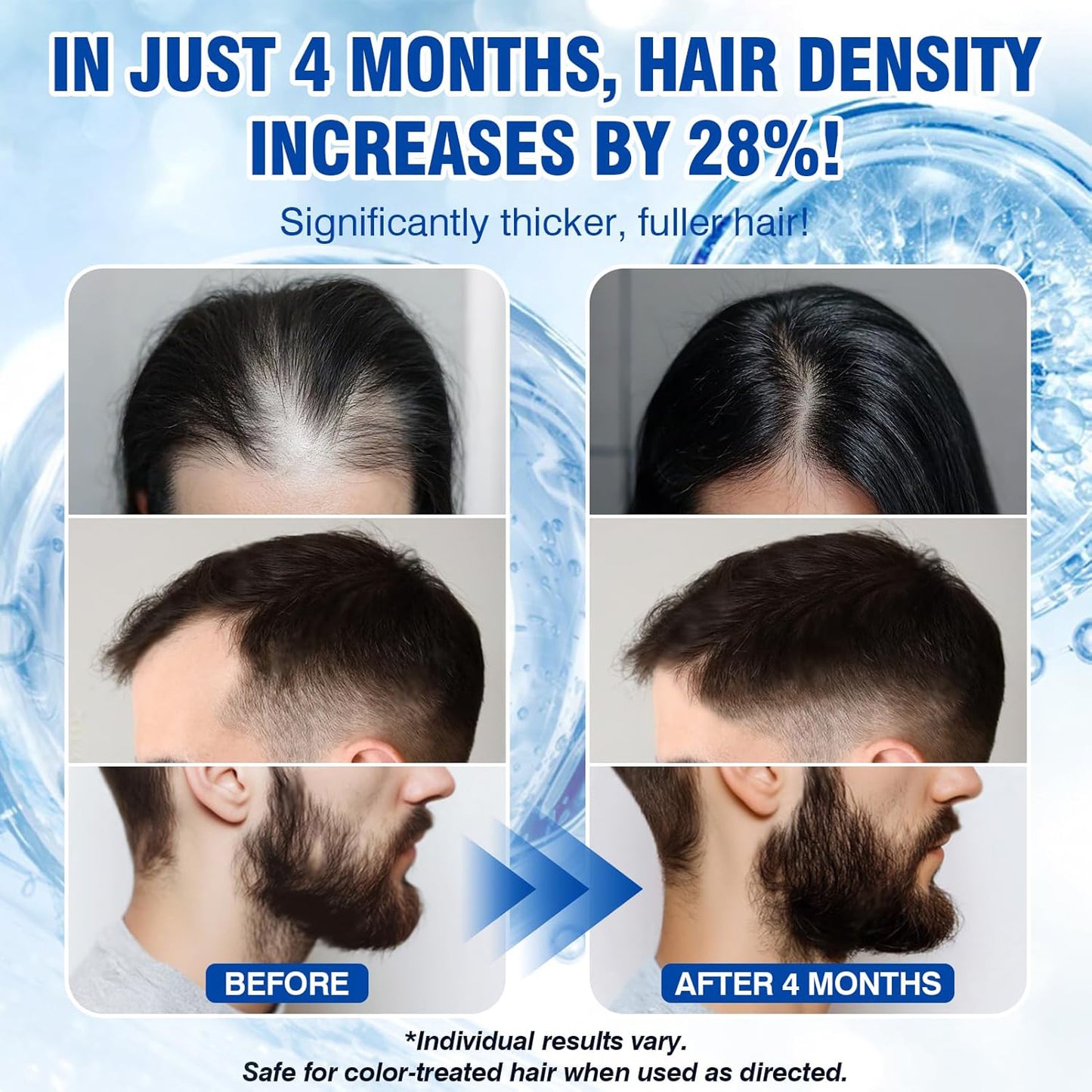 🔥🔥🔥HOT SALE 50% OFF💥 Fast Hair Growth Serum 💁♀️