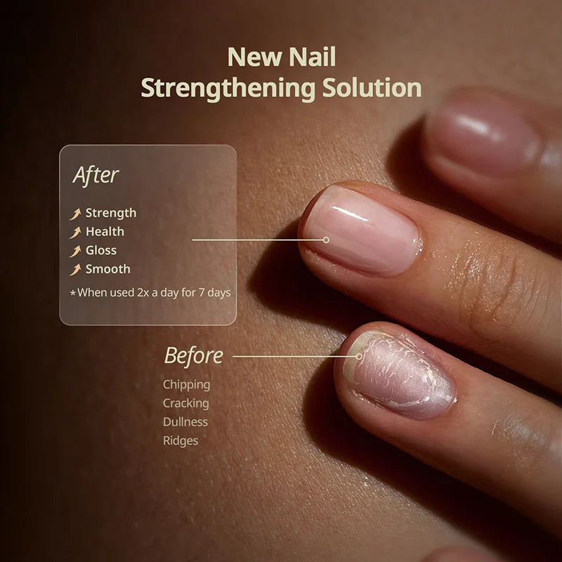 🔥Flash Sale 58% OFF🔥Nail Protection Oil : Strengthen and Grow Your Nails Safely
