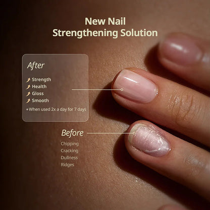 🔥Flash Sale 58% OFF🔥Nail Protection Oil : Strengthen and Grow Your Nails Safely