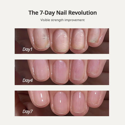 🔥Flash Sale 58% OFF🔥Nail Protection Oil : Strengthen and Grow Your Nails Safely