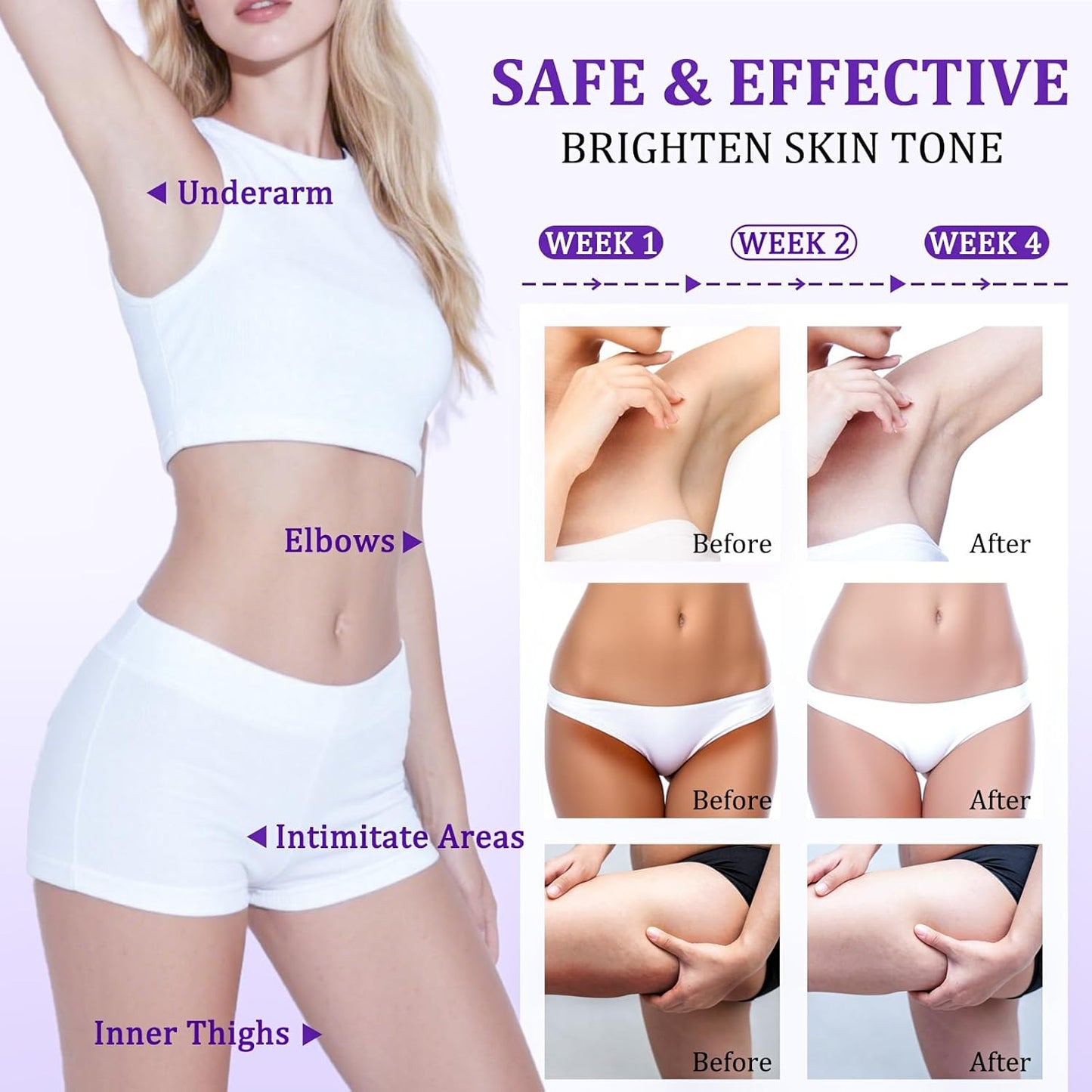 🔥Final 3 Hours: 33% OFF🔥：Dark Spot Remover for Body, Skin Bleaching Cream with Vitamin C for Intimate Areas