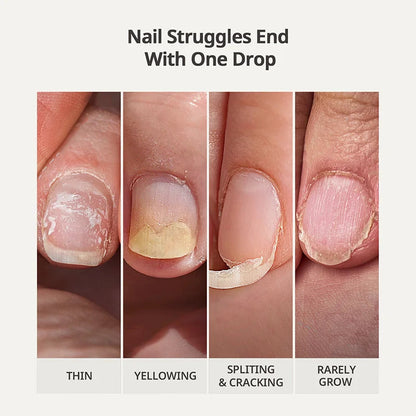 🔥Flash Sale 58% OFF🔥Nail Protection Oil : Strengthen and Grow Your Nails Safely