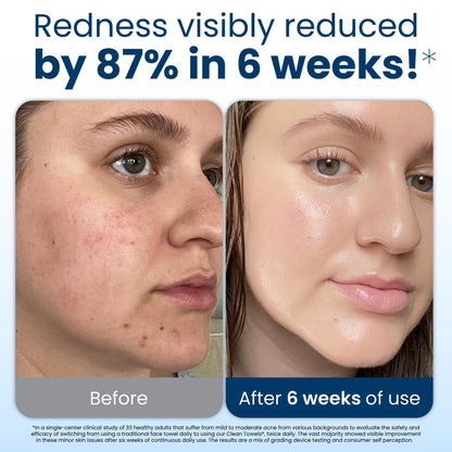 HOT SALE 50% OFF🔥50 Sterile Towels Clinically Proven to Reduce Redness, 100% Vegan & Cruelty-Free，FSC Certified Fibers.