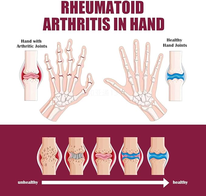 2PCS Perfectx Joint & Bone Cream,Perfectx Body Cream